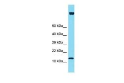 IQCF6 Rabbit anti-Human, Polyclonal, Novus Biologicals 100 &mu;g | Buy Online | Novus Biologicals | Fisher Scientific